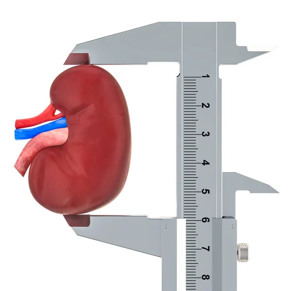 Menselijke Nier Met Schuifmaat Gemeten Onderzoek Diagnose Van Nier Concept — Stockfoto