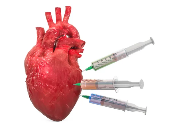 Tratamiento Del Concepto Cardiopatía Representación Aislada Sobre Fondo Blanco —  Fotos de Stock