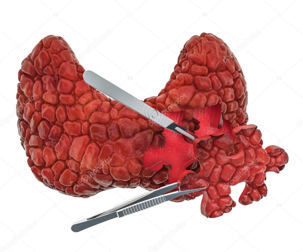 Thyroid surgery concept, 3D rendering isolated on white background