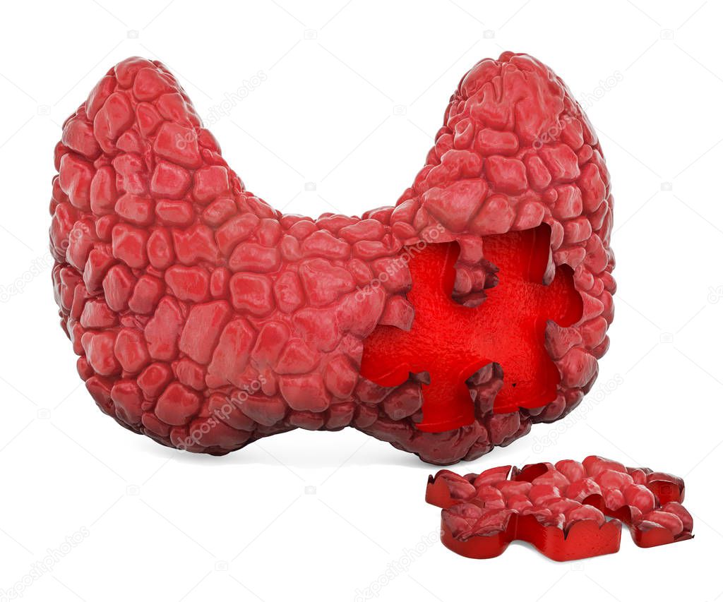 Thyroid gland disease concept, 3D rendering isolated on white background
