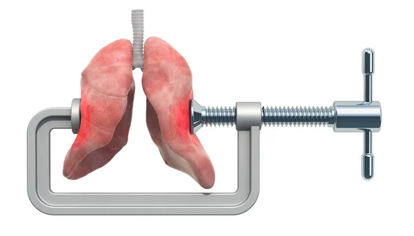 Ból Płucach Koncepcja Choroby Płuc Vise Płuc Człowieka Renderowania Białym — Zdjęcie stockowe