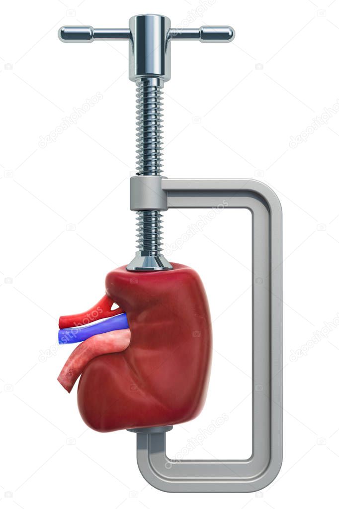 Pain in kidneys, chronic kidney disease concept. Vise with kidney, 3D rendering isolated on white background