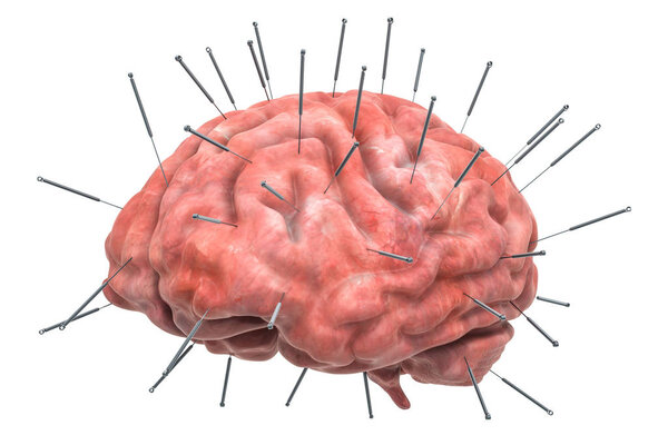 Human brain with acupuncture needles. Acupuncture treatment concept, 3D rendering isolated on white background