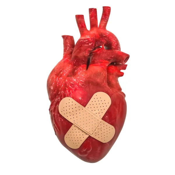 Corazón Humano Con Yeso Adhesivo Tratamiento Del Concepto Cardiopatía Representación — Foto de Stock