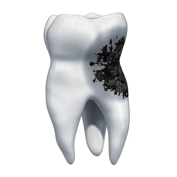 Tooth Met Cariës Kiespijn Concept Rendering Geïsoleerd Witte Achtergrond — Stockfoto