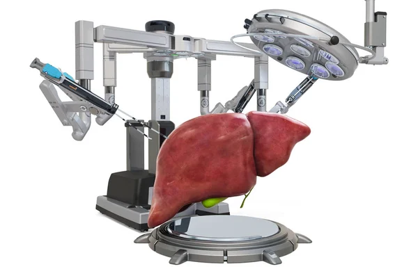 Роботизована хірургія концепції печінки, 3D рендеринга — стокове фото