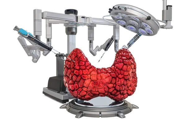 Chirurgia robotica del concetto di tiroide, rendering 3D — Foto Stock