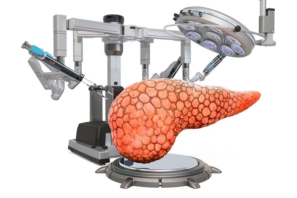 Robotische Chirurgie der Bauchspeicheldrüse, 3D-Rendering — Stockfoto