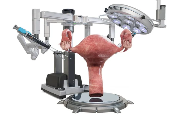 Cirurgia robótica do conceito do útero, renderização 3D — Fotografia de Stock