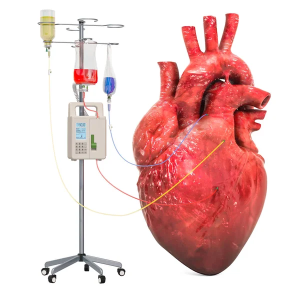 Intravenous therapy system with human heart. Treatment of heart — Stock Photo, Image