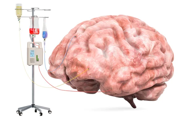 Intravenous therapy system with human brain. Treatment of Brain — Stock Photo, Image