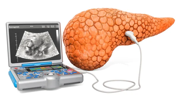 Conceptul de ultrasunete pancreatice. Pancreas uman cu ultra medicală — Fotografie, imagine de stoc