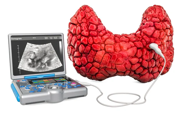 Thyroid Ultrasound concept. Human thyroid with medical ultrasoun — Stock Photo, Image