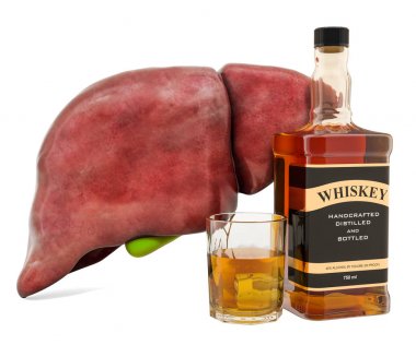 Alcohol-related liver disease, human liver with alcohol drink clipart