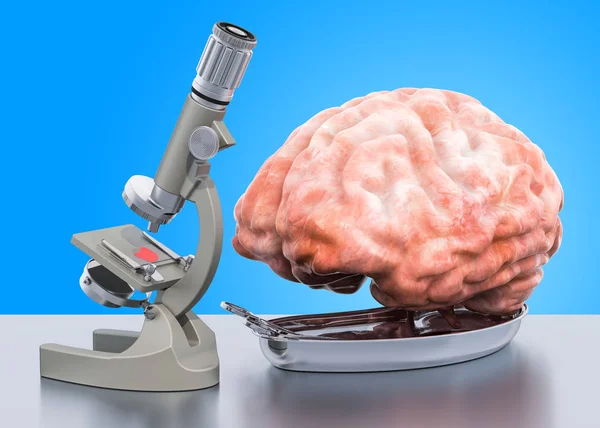 Έρευνα και διάγνωση της έννοιας της εγκεφαλικής νόσου — Φωτογραφία Αρχείου