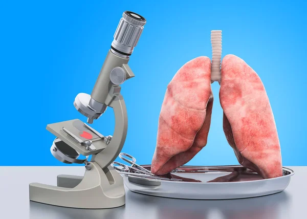 Дослідження та діагностика концепції захворювання легенів — стокове фото