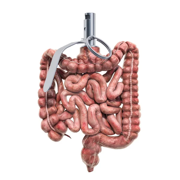 Dolor en los intestinos, concepto de enfermedad intestinal. Intestinos humanos — Foto de Stock