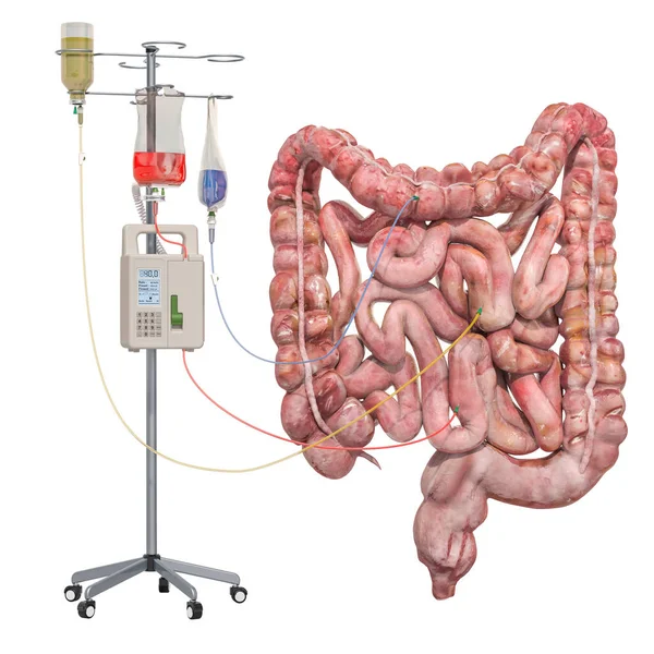 Système de thérapie intraveineuse avec intestins humains — Photo