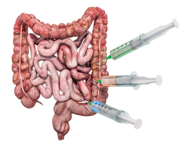 Tratamiento y medicamentos para la enfermedad intestinal, renderización 3D — Foto de Stock
