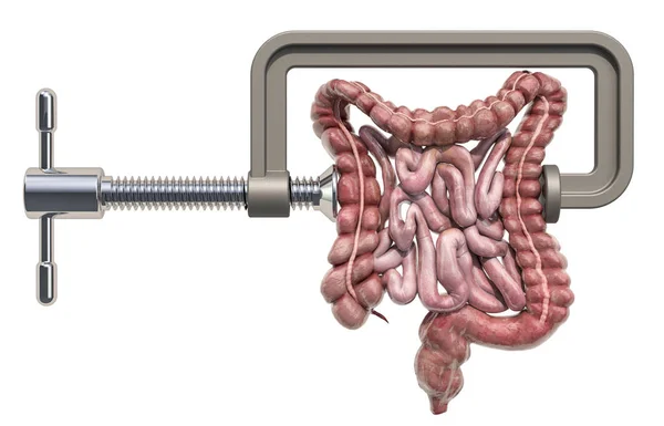 Concepto de dolor abdominal. Vise con intestino humano. Renderizado 3D — Foto de Stock