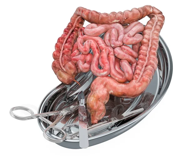 Concepto de cirugía de trasplante intestinal. Intestinos de donantes en bandeja metálica — Foto de Stock