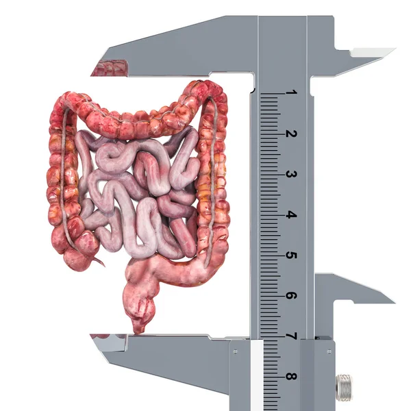 Human bowel with vernier caliper. Research and diagnosis of intestines — Stock Photo, Image