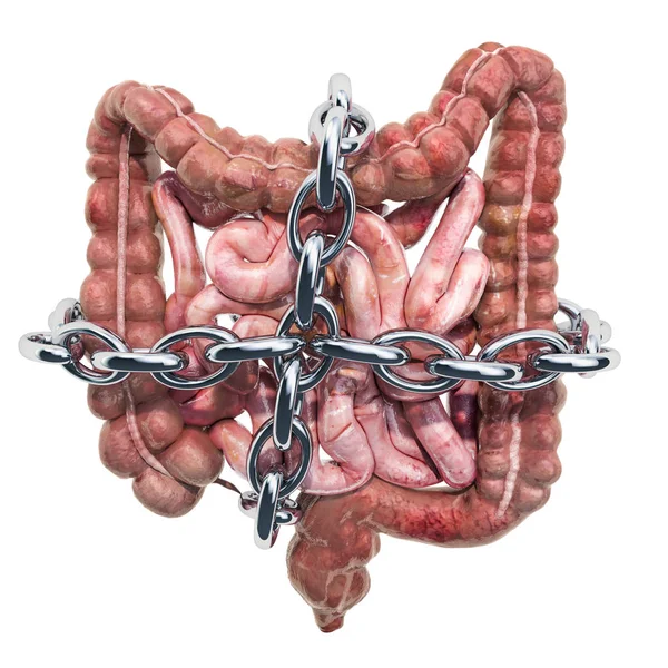 Intestinos humanos con cadena. Concepto de dolor abdominal — Foto de Stock