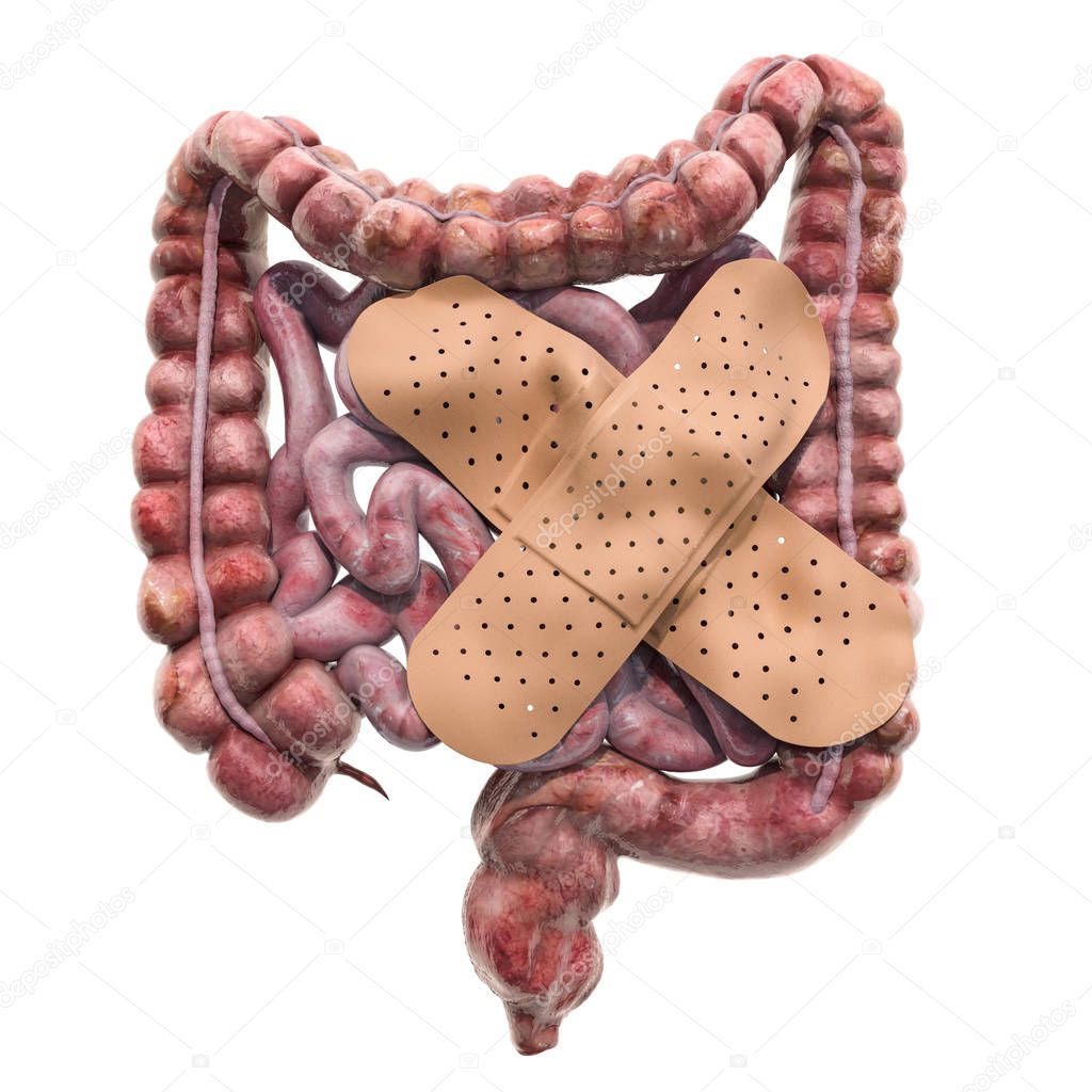 Human bowel with adhesive bandages. Treatment of intestines