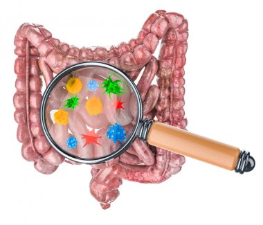 Bağırsak hastalıkları kavramının araştırılması ve teşhisi
