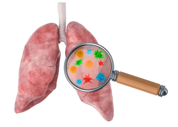 Akciğer hastalıkları kavramının araştırılması ve teşhisi — Stok fotoğraf