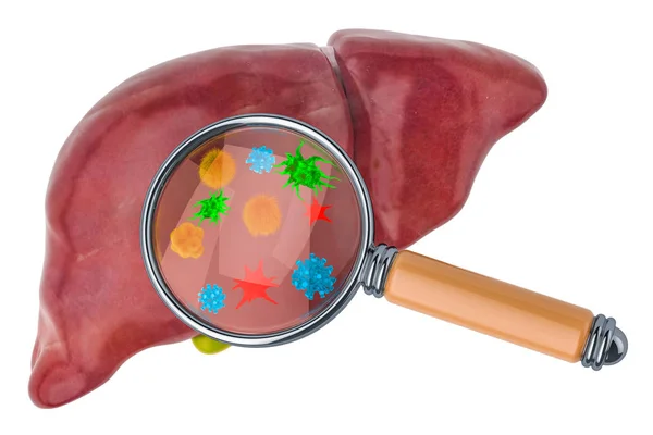 Research and diagnosis of liver diseases concept — Stock Photo, Image