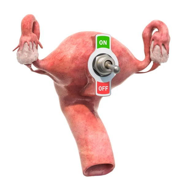 Female uterus with toggle switch. Female infertility — Stock Photo, Image