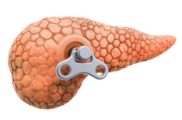 Menschliche Bauchspeicheldrüse mit Aufwickelschlüssel. Behandlungs- und Erholungskonzept — Stockfoto
