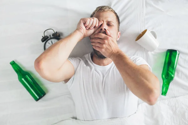 Jovem Homem Bonito Cama Manhã Após Noite Fora Beber — Fotografia de Stock