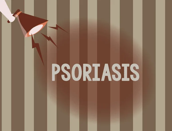 Signo de texto que muestra psoriasis. Foto conceptual Afección común de la piel que acelera el ciclo de vida de las células de la piel — Foto de Stock