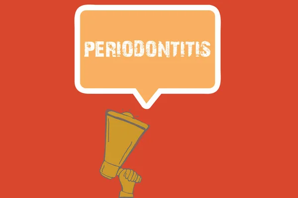 Signo de texto que muestra periodontitis. Foto conceptual Hinchazón del tejido alrededor de los dientes Encogimiento de las encías —  Fotos de Stock