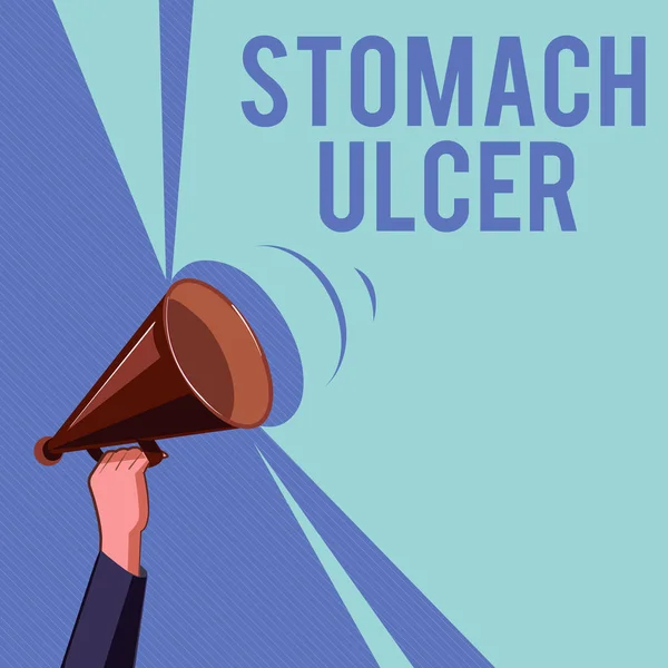 Sinal de texto mostrando úlcera de estômago. Foto conceitual Feridas abertas que se desenvolvem no revestimento interno do estômago — Fotografia de Stock