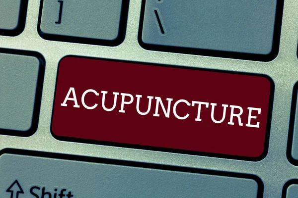 Konceptuella hand skriva visar akupunktur. Företag foto skylta alternativ terapi behandling för smärta och sjukdom med nål — Stockfoto