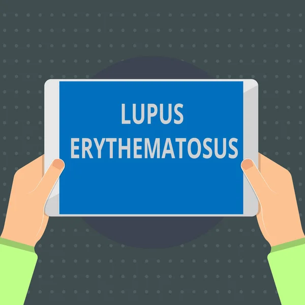 Lupus Eritematozus gösterilen metin işareti. Otoimmün bir hastalığın neden kavramsal fotoğraf inflamatuar durumu — Stok fotoğraf