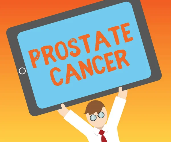 Note d'écriture montrant le cancer de la prostate. Photo d'affaires montrant le cancer qui se produit dans la glande du système reproducteur masculin — Photo