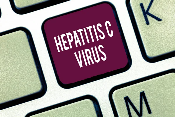 Ordet skriver text hepatitC-Virus. Affärsidé för infektiöst agens som orsakar viral hepatit sjukdom — Stockfoto