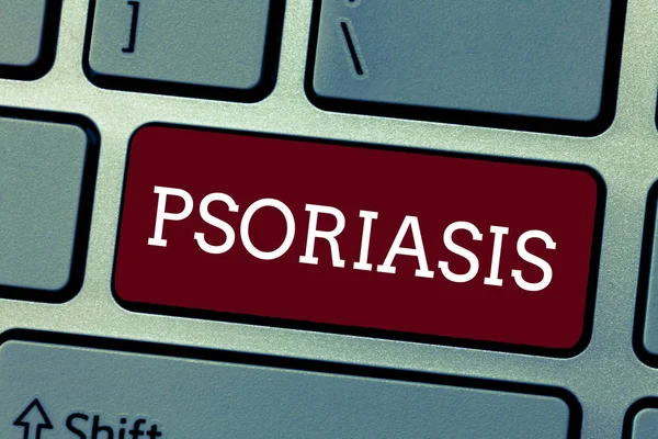 Escritura manual conceptual que muestra Psoriasis. Exhibición de fotos de negocios Condición común de la piel que acelera el ciclo de vida de las células de la piel — Foto de Stock