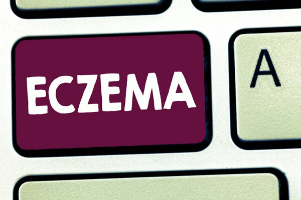 Sinal de texto mostrando Eczema. Foto conceitual Condição cutânea marcada por prurido e manchas inflamadas Dermatite atópica — Fotografia de Stock