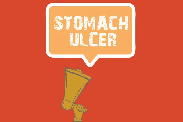 Текстовий знак, що показує Stomach Ulcer. Концептуальне фото Відкриті виразки, які розвиваються на внутрішній підкладці вашого шлунка — стокове фото