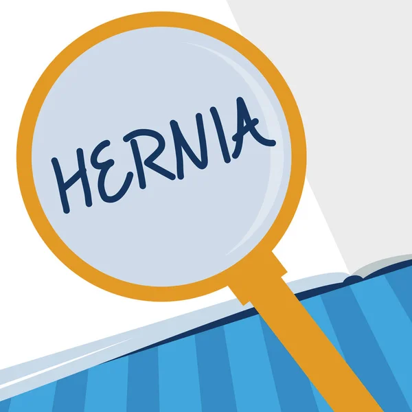 Schrijven van notitie weergegeven: Hernia. Zakelijke foto presentatie van abnormale exit van weefsel of een orgaan door de wand van de holte — Stockfoto