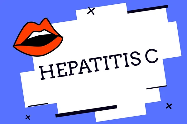 Schrijven van de notitie weergegeven: Hepatitis C. Business foto presentatie van ontsteking van de lever als gevolg van een virale infectie leverziekte — Stockfoto