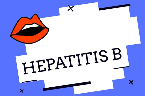Schreiben Notiz zeigt Hepatitis b. Geschäftsfoto zeigt schwere Form der viralen Hepatitis, die in infiziertem Blut übertragen wird — Stockfoto