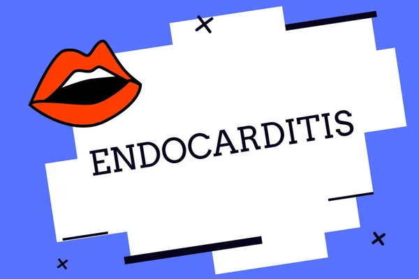 Escribiendo nota mostrando Endocarditis. Foto de negocios mostrando Infección grave e hinchazón de la capa interna del corazón — Foto de Stock