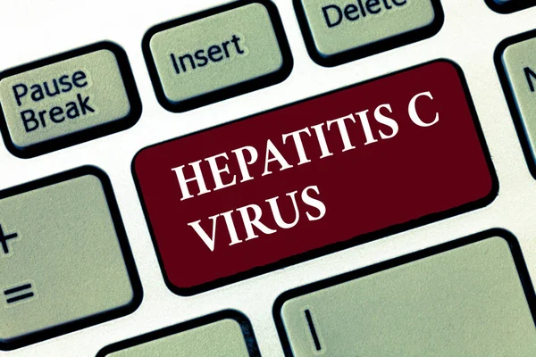 Word writing text Hepatitis c virus. Geschäftskonzept für Infektionserreger, die virale Hepatitis verursachen — Stockfoto