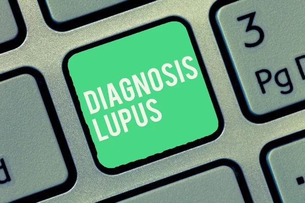 Signo de texto que muestra diagnóstico de lupus. Foto conceptual El examen de orina muestra un aumento del nivel de proteína — Foto de Stock